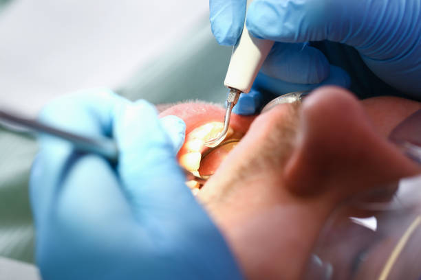 Best Emergency TMJ Treatment in Lexico, CA