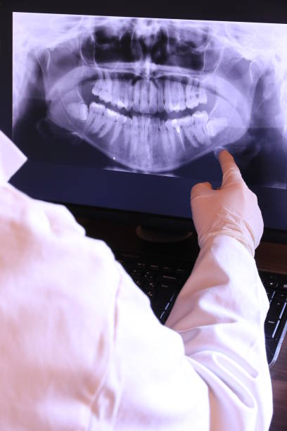 Best Emergency Wisdom Teeth Removal in Lexico, CA